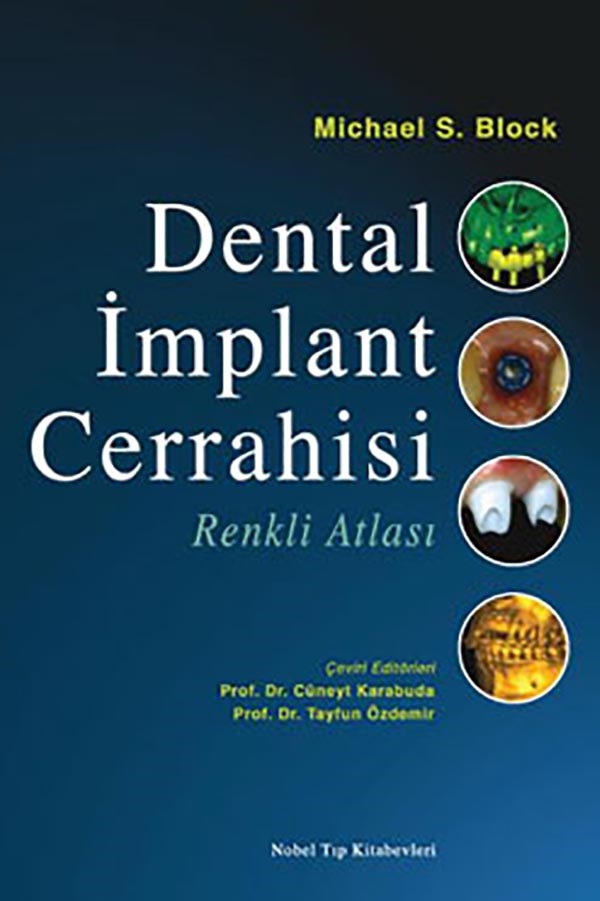 Dental-Implant-Cerrahisi-Renkli-Atlas