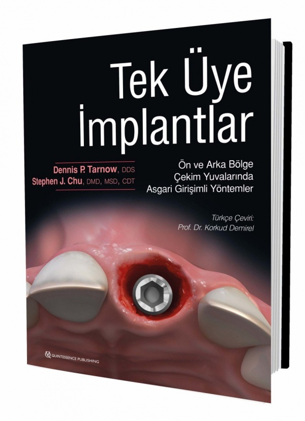 Tek-uye-implantlar---On-ve-Arka-Bolge-Cekim-Yuvalarinda-Asgari-Girisimli-Yontemler