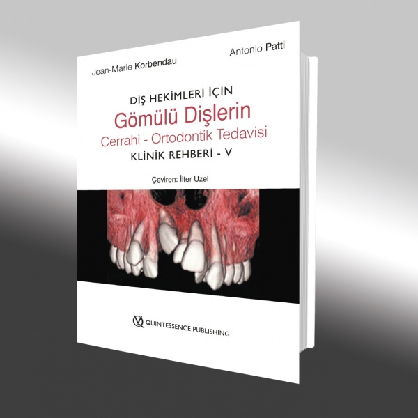 dis-hekimleri-icin-gomulu-dislerin-cerrahi-ortodontik-tedavisi-klinik-rehberi-v