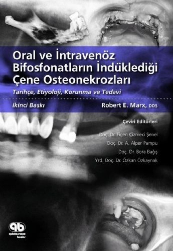 oral-ve-intravenoz-bifosfonatlarin-indukledigi-cene-osteonekrozlari