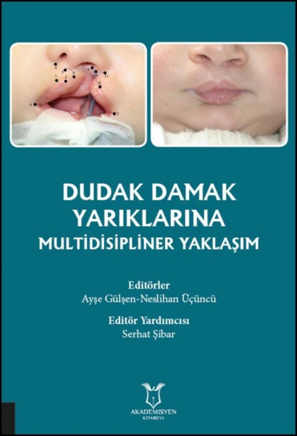 dudak-damak-yariklarina-multidisipliner-yaklasim