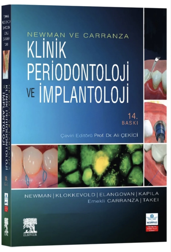 newman-ve-carranza-klinik-periodontoloji-ve-implantoloji-14-baski