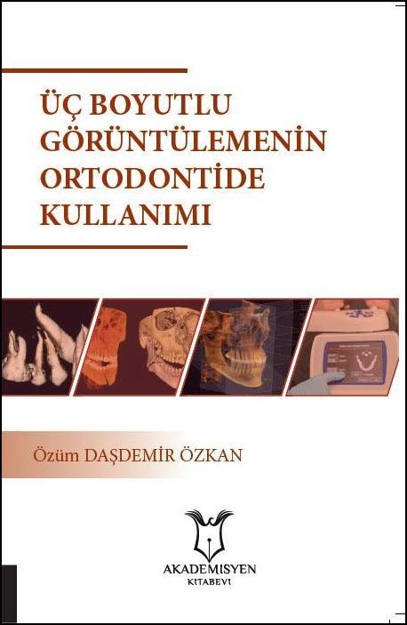 uc-boyutlu-goruntulemenin-ortodontide-kullanimi