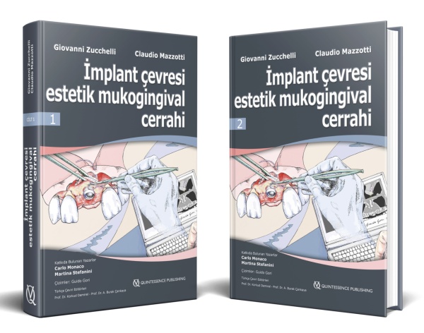 implant-cevresi-estetik-mukogingival-cerrahi