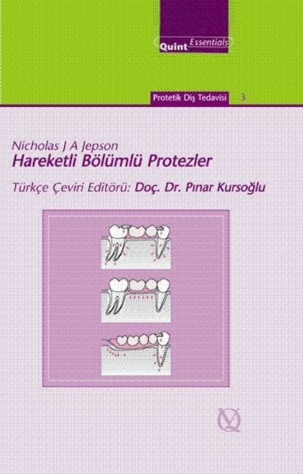 hareketli-bolumlu-protezler