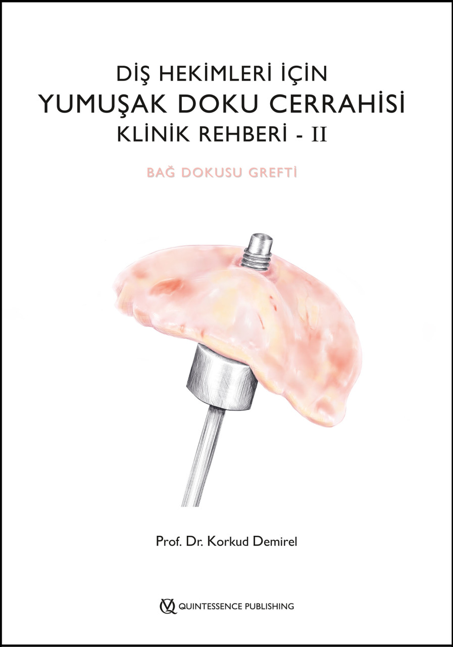 dis-hekimleri-icin-yumusak-doku-cerrahisi-klinik-rehberi-ii-bag-dokusu-grefti