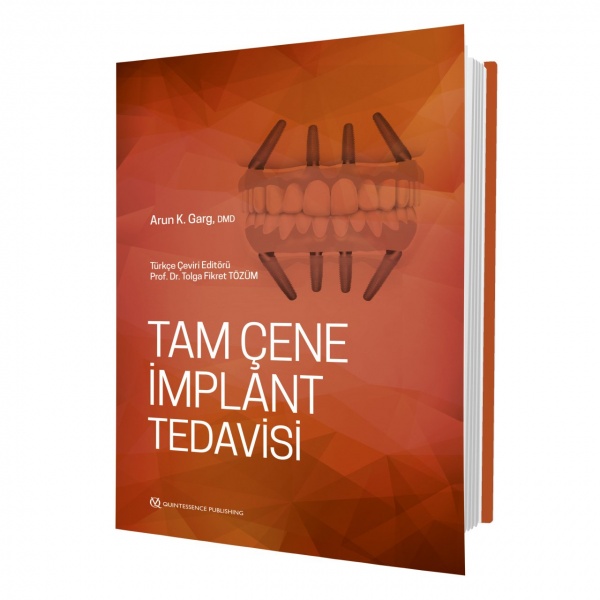 tam-cene-implant-tedavisi