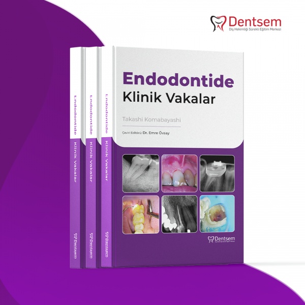 Endodontide Klinik Vakalar 