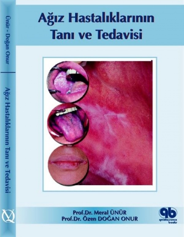 agiz-hastaliklarinin-teshis-ve-tedavisi