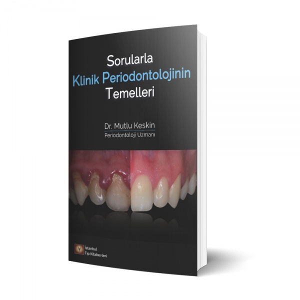 sorularla-klinik-periodontolojinin-temelleri
