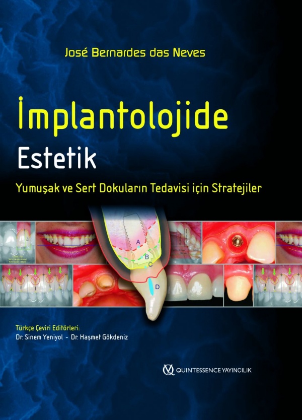 implantolojide-estetik-yumusak-ve-sert-dokularin-tedavisi-icin-stratejiler