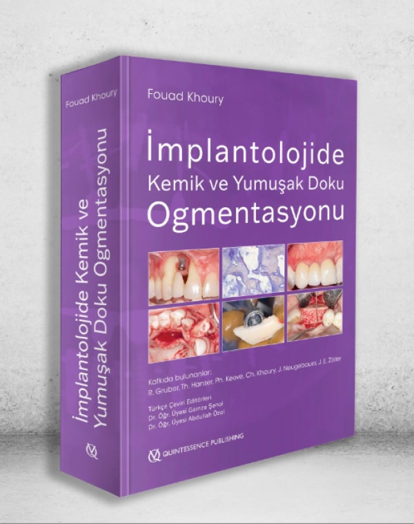 implantolojide-kemik-ve-yumusak-doku-ogmentasyonu