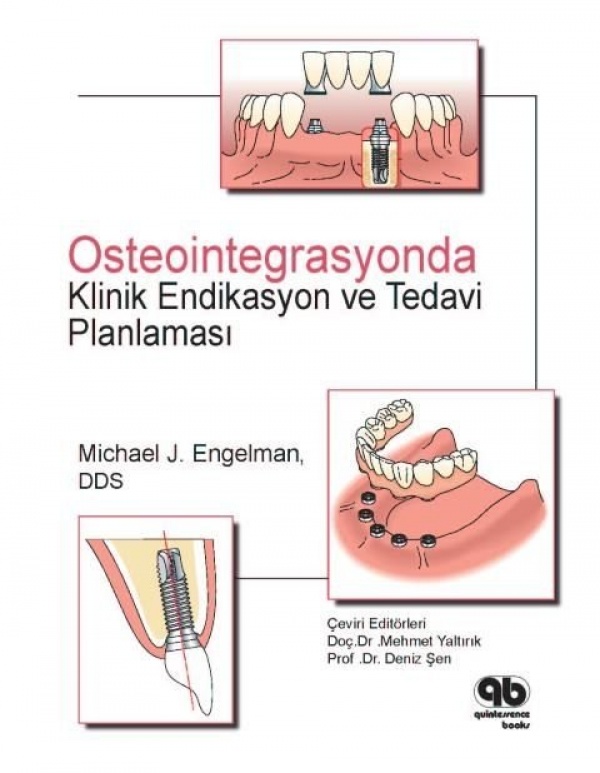 osteointegrasyonda-klinik-endikasyon-ve-planlama