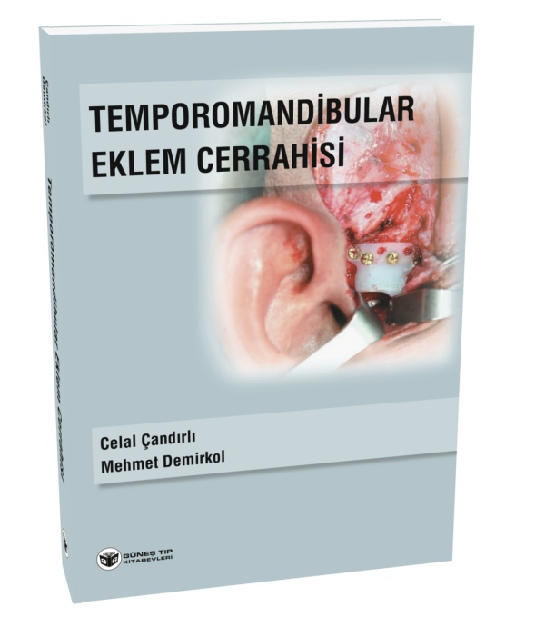 temporomandibular-eklem-cerrahisi