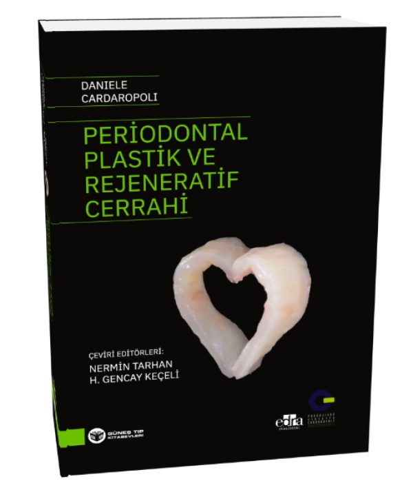 periodontal-plastik-ve-rejeneratif-cerrahi