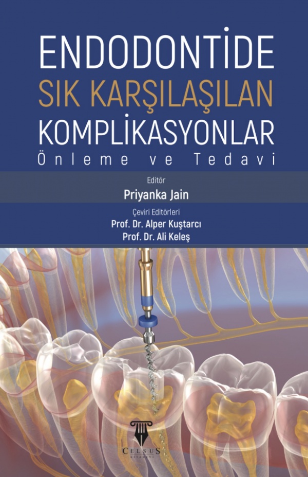endodontide-sik-karsilasilan-komplikasyonlar