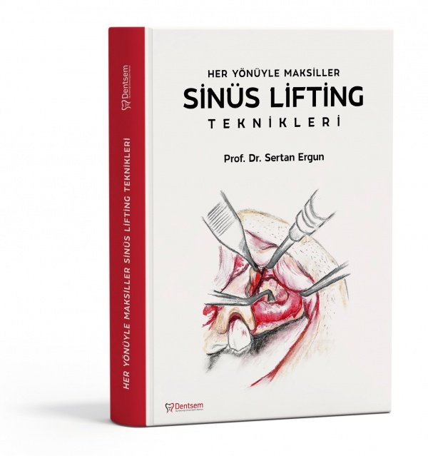 'Her Yönüyle Maksiller Sinüs Lifting Teknikleri' kitabı çıktı