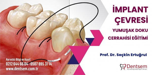 İmplant Çevresi Yumuşak Doku Cerrahisi Kursu
